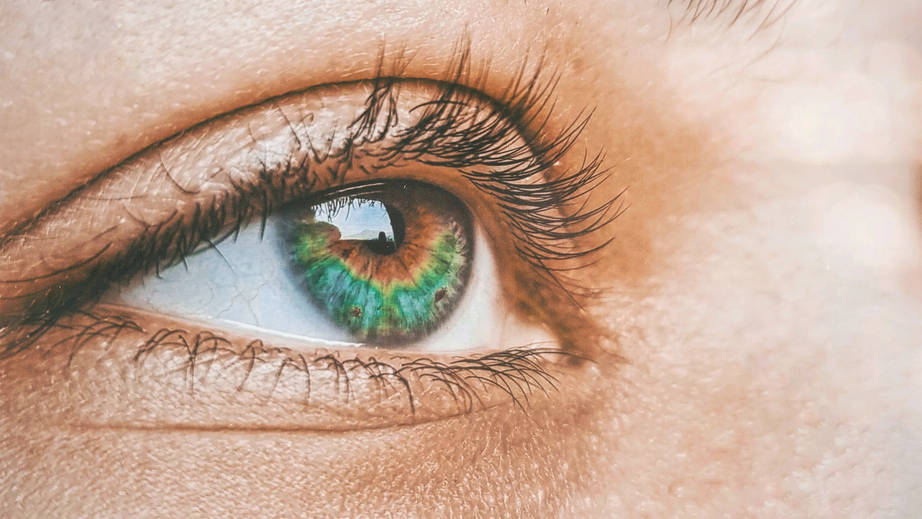 What Is Cataract Surgery?