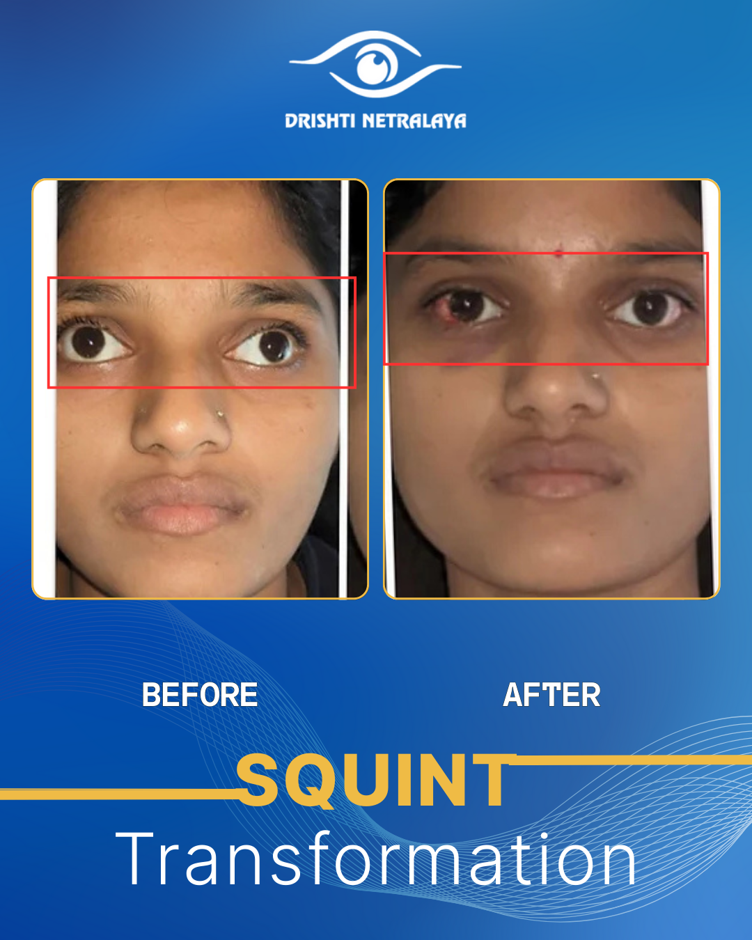 Before After Image 10