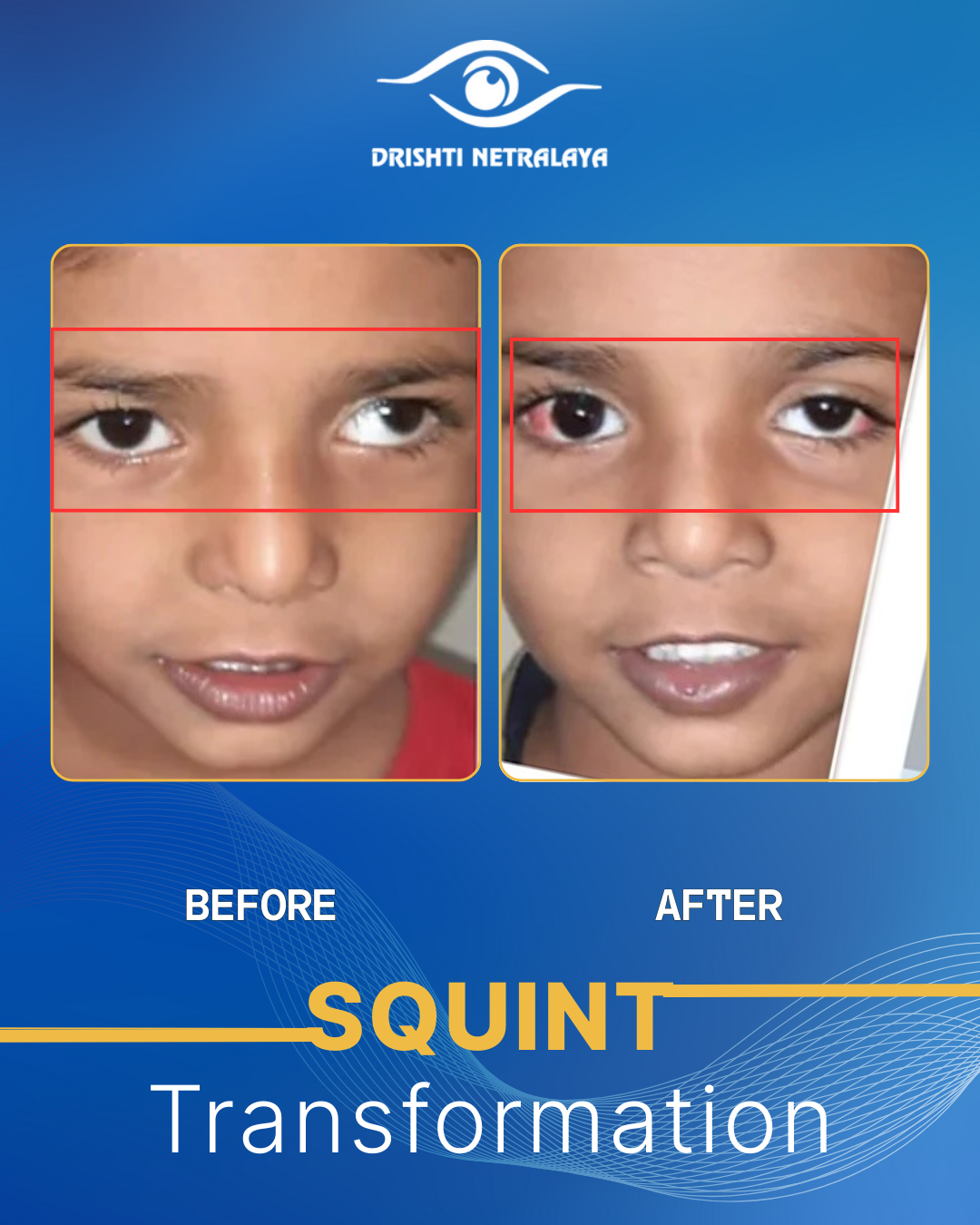 Before After Image 2
