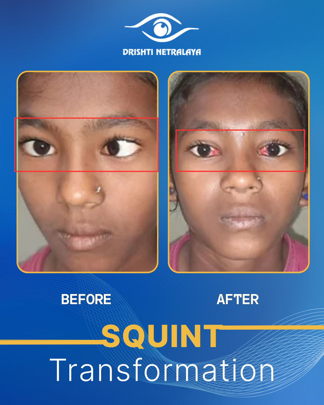 Before After Image 3