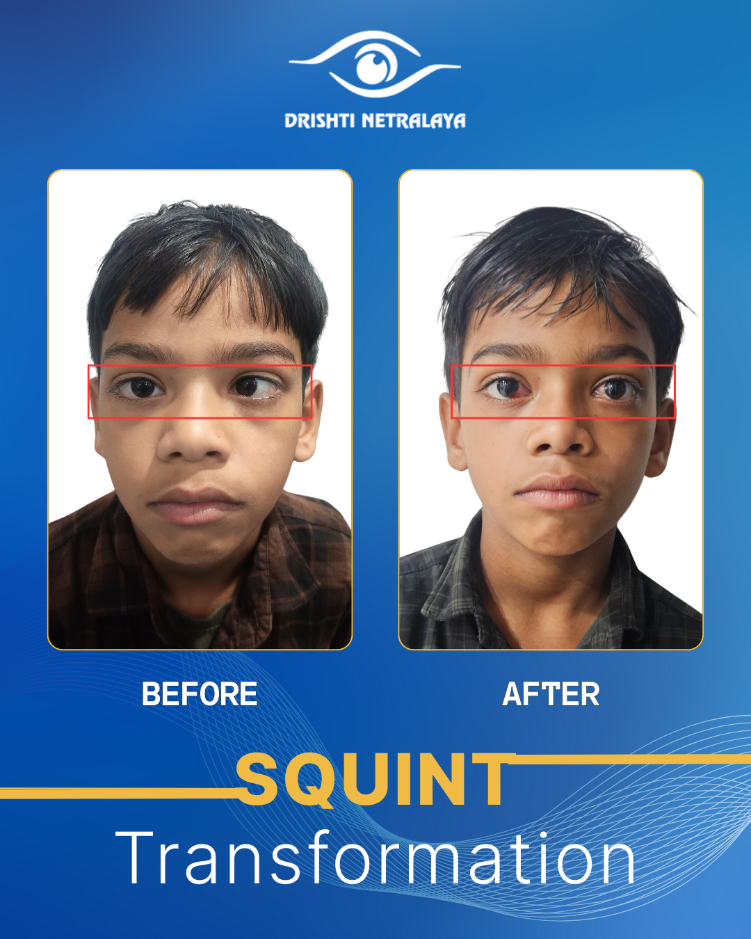 Before After Image 4
