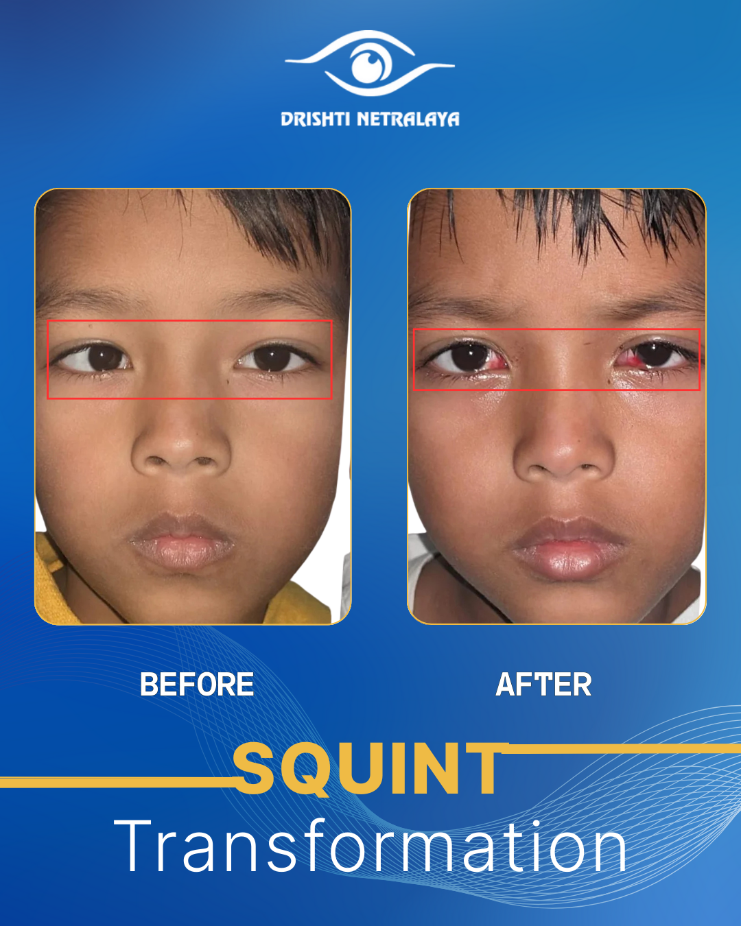 Before After Image 5