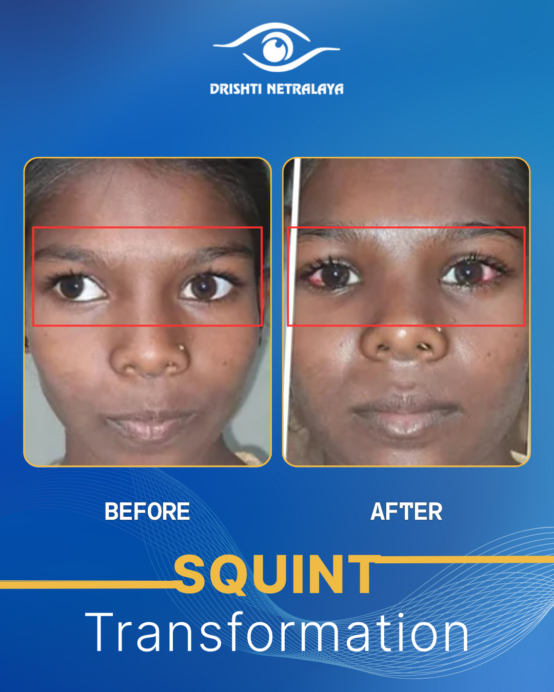 Before After Image 6