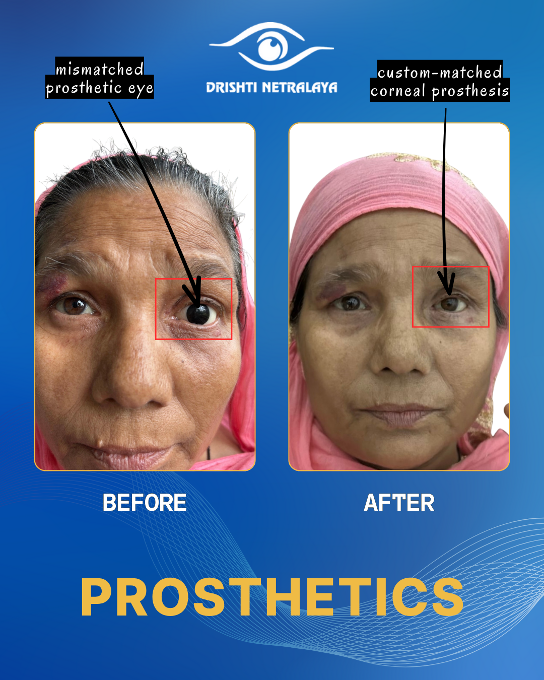 Before After Image 9