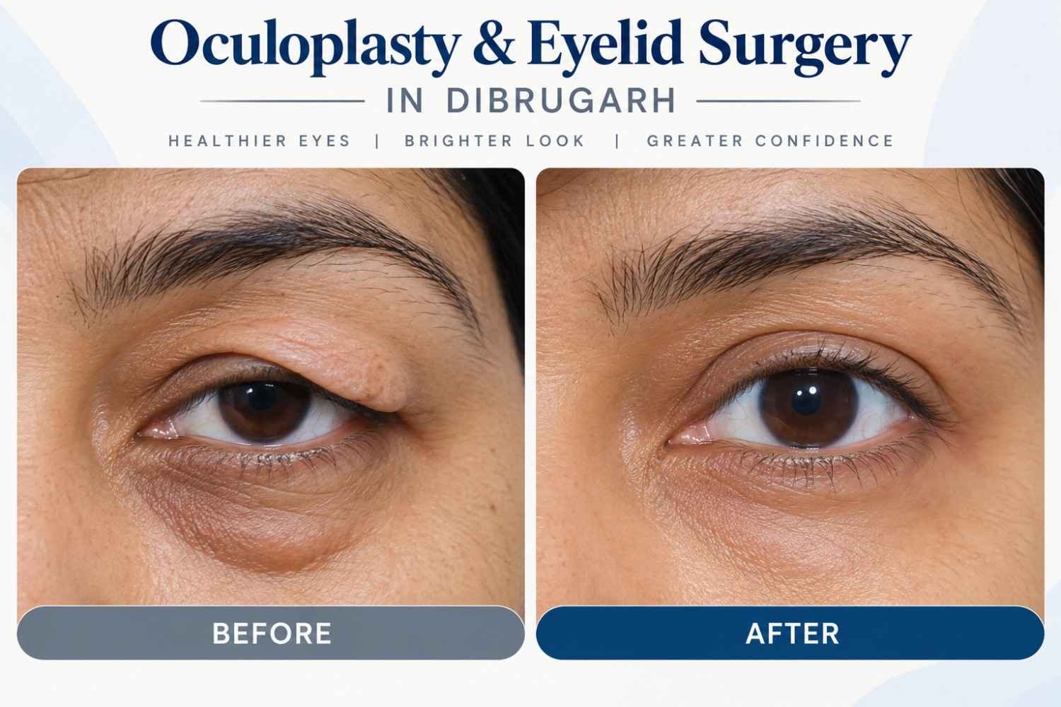 Oculoplasty Evaluation